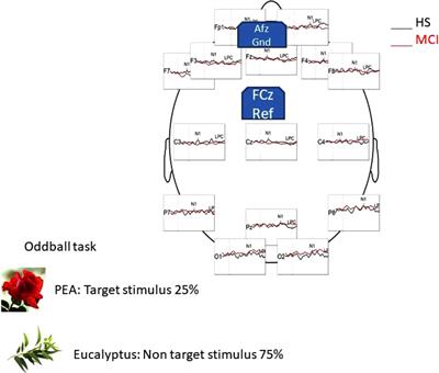 Potential Role of OERP as Early Marker of Mild Cognitive Impairment